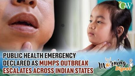 PUBLIC HEALTH EMERGENCY DECLARED AS MUMPS OUTBREAK ESCALATES ACROSS INDIAN STATES