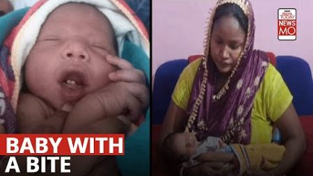 A Rare Child With Teeth Born in Sadar Hospital Parsudih, Jamshedpur
