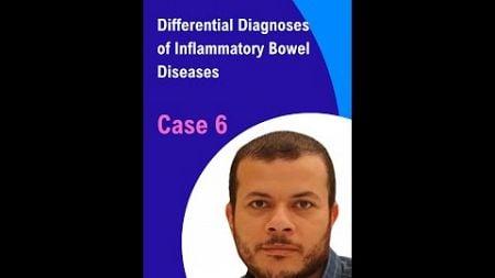 Differential Diagnoses of Inflammatory Bowel Disease: Case 6