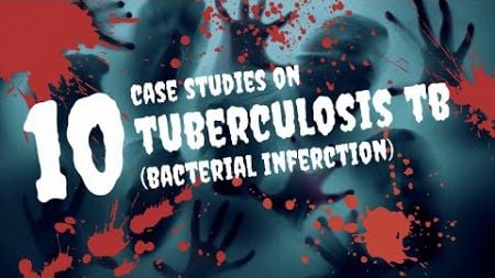 Tuberculosis TB: 10 Case Studies In-Depth Case Studies and Treatment Strategies #diabetes #DRUGLAB