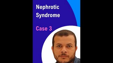 Nephrotic Syndrome: Clinical Presentations and Diagnosis: Case 3