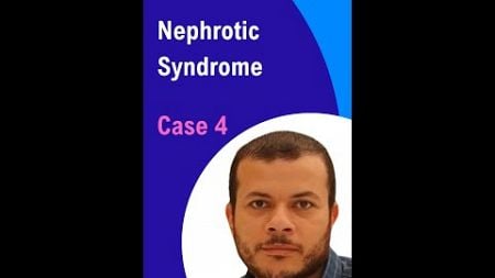 Nephrotic Syndrome: Clinical Presentations and Diagnosis: Case 4