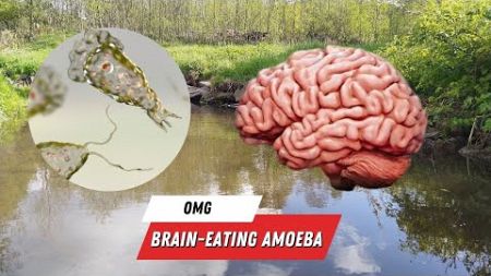 Israel Treats First Living Brain-Eating Amoeba Patient
