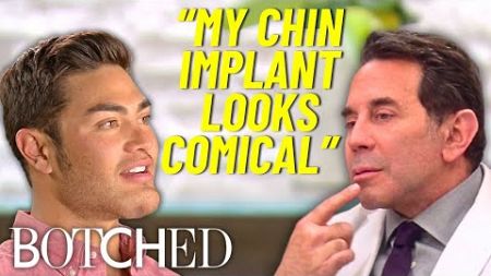 Will&#39;s “American Dad” Chin Implant Removal Reveals Deeper Body Dysmorphia Issues | Botched | E!