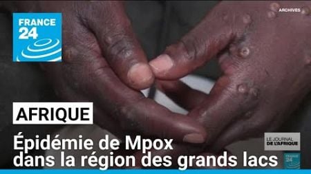 L&#39;épidémie de Mpox se développe dans la région des grands lacs en Afrique • FRANCE 24