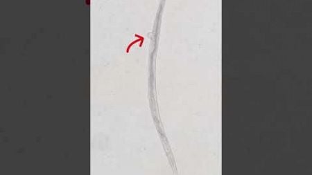 Pineapple Juice vs Parasites #health #microscope #viralshorts #fyp