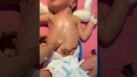 Her Skin Like Old Man#medical #newbornbaby #viralvideo