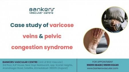 Case study of varicose veins &amp; pelvic congestion syndrome