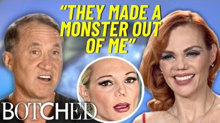 REJECTED By Botched: Carmen&#39;s Top Model Nose Destroyed In Freak Accident | Botched | E!