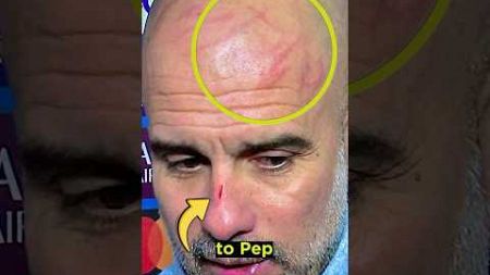 What happened to Pep Guardiola’s face?