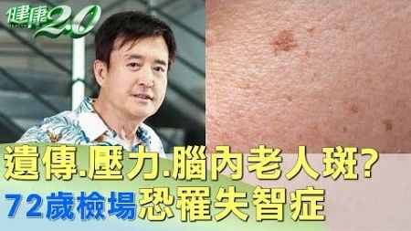 遺傳.壓力.腦內老人斑? 72歲檢場恐罹失智症 健康2.0 @tvbshealth20