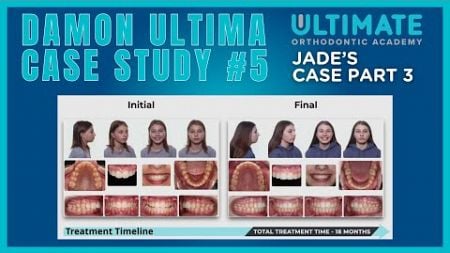 Damon Ultima System - Case Study #5 Part 3