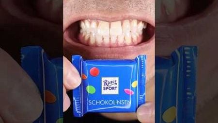 ASMR | Ritter Sport Milk Chocolate with MultiHue Sugar Pearls! #DoctorTristan Peh#ASMR#RitterSport