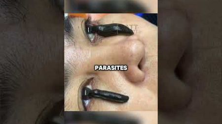 Pourquoi ces parasites sont dans leurs yeux?😲