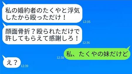 兄の結婚式の日、私を不倫相手だと誤解して殴り、顔を骨折させたDQNの婚約者がいました→誤解を解いた時のその女性の反応がwww