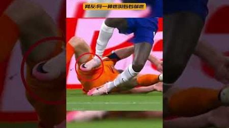 此球员遭受到比生孩子还剧烈的疼痛#体育#足球#运动 #足球 #sports #football